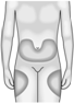 Aranesp body new