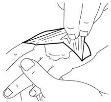 emla-cream-remove-cover-from-hand-(black)