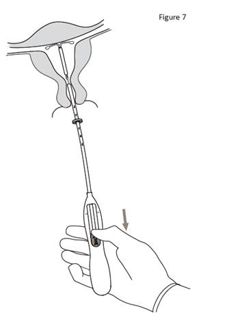 Figure 7